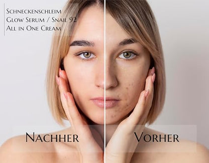 Snail 92 - Schneckenschleim Glow Serum